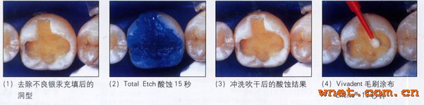 点击放大